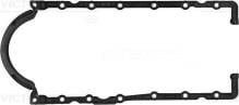 REINZ 71-31615-00